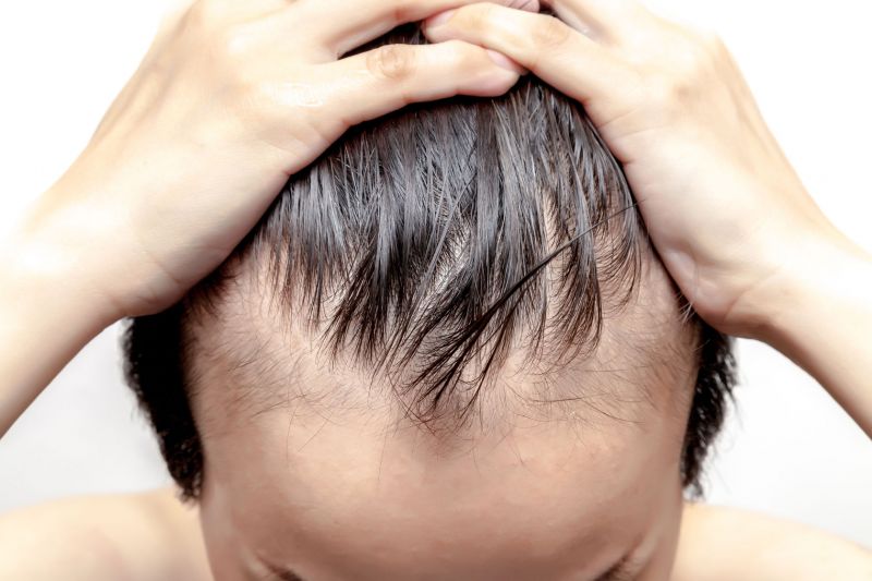 जानिए क्या है गंजे सर में बाल लाने का आसान तरीका