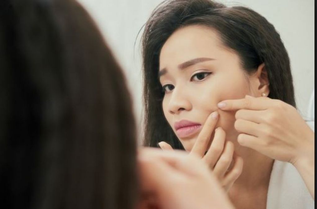 Facial pimple can affect your mind too, know how