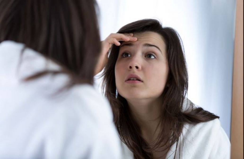 Facial pimple can affect your mind too, know how