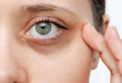 How to Avoid Dark Circles in Humid Summers: Easy Tricks to Know