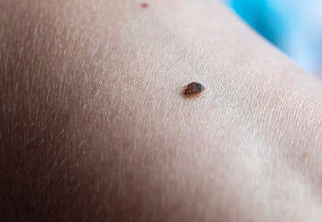 If You Get Bites as Soon as You Lie on the Bed, It Might Be Bed Bugs: Here's How to Get Rid of Them