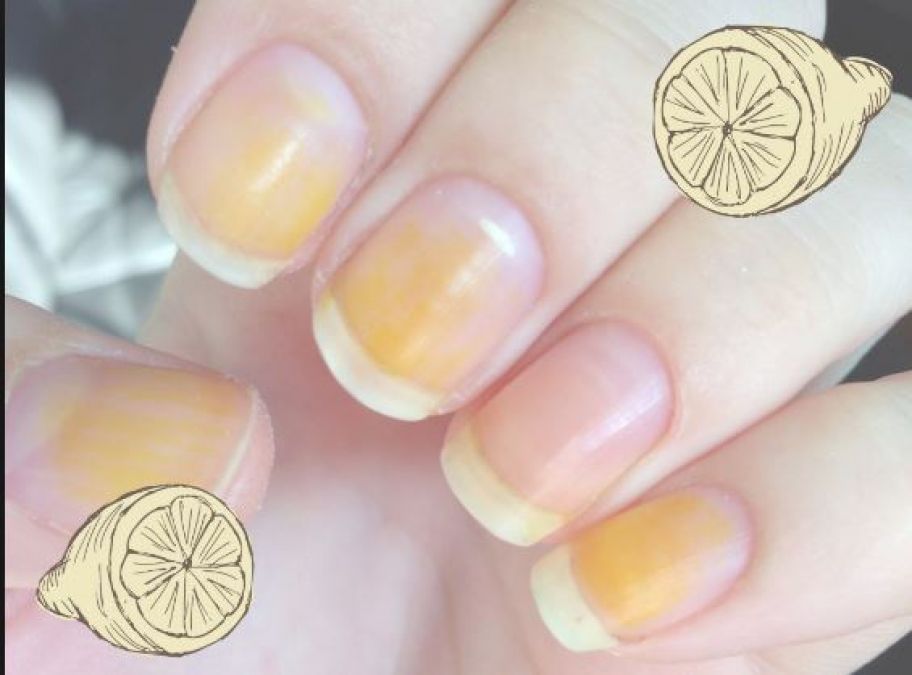 Natural Way To Whiten Yellow Nails A Quick Trick to Make your Nails look Whiter