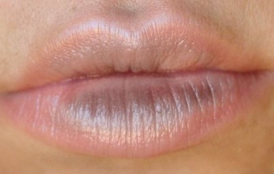 Due to this, lips become black, know how to get rid of it