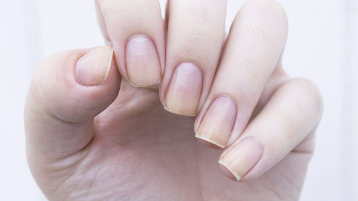 If the skin is coming out of the nails even after Manicure, then treat it in this way