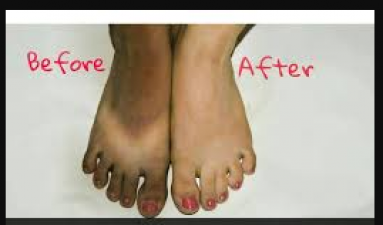 Take care of these things to make ugly feet beautiful