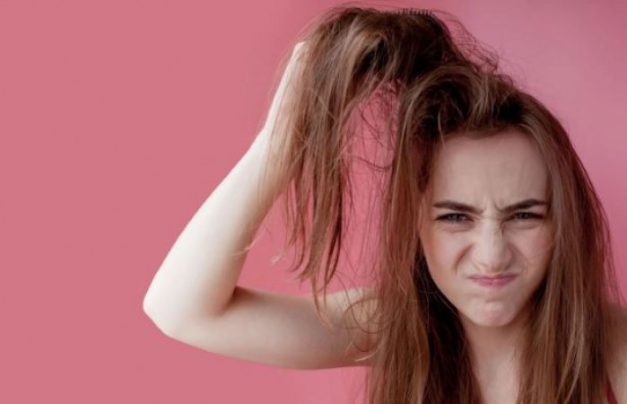 Are you also troubled by sticky hair? So follow these tips