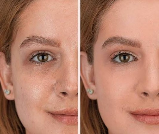 Does Makeup Struggle to Stick on Oily Skin? Keep These Things in Mind