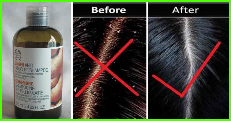 ये हैं 5 बेस्ट हर्बल शैम्पू जो आपके बालों को रखेंगे हमेशा डैंड्रफ से दूर