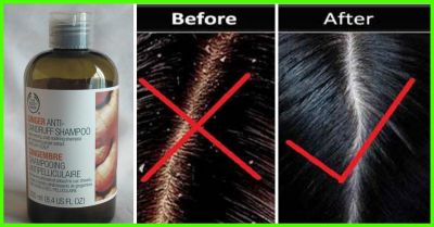 ये हैं 5 बेस्ट हर्बल शैम्पू जो आपके बालों को रखेंगे हमेशा डैंड्रफ से दूर