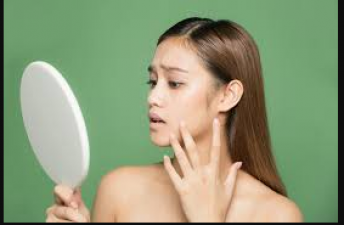 Applying moisturizer in winter can cause damage to the skin