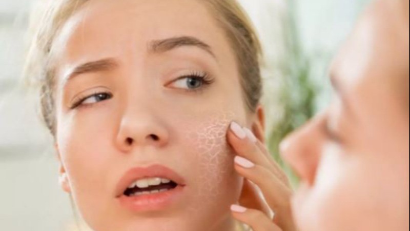 Apply These Remedies to Dry Skin Before Sleeping at Night to Eliminate Dryness