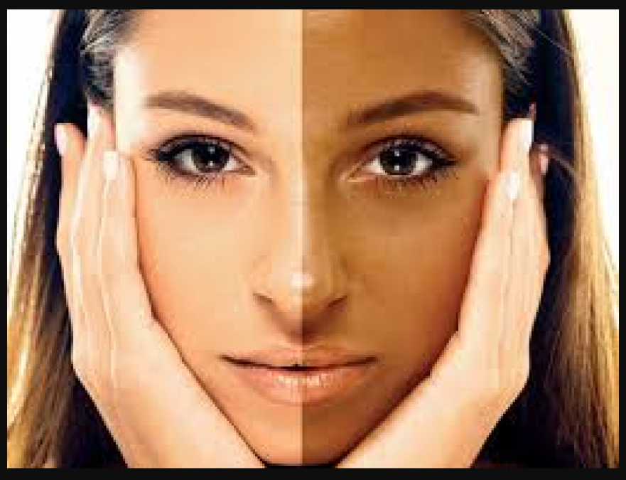 Know these tips to remove blackness from face