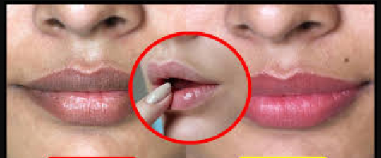 Try these home remedies to get naturally pink lips