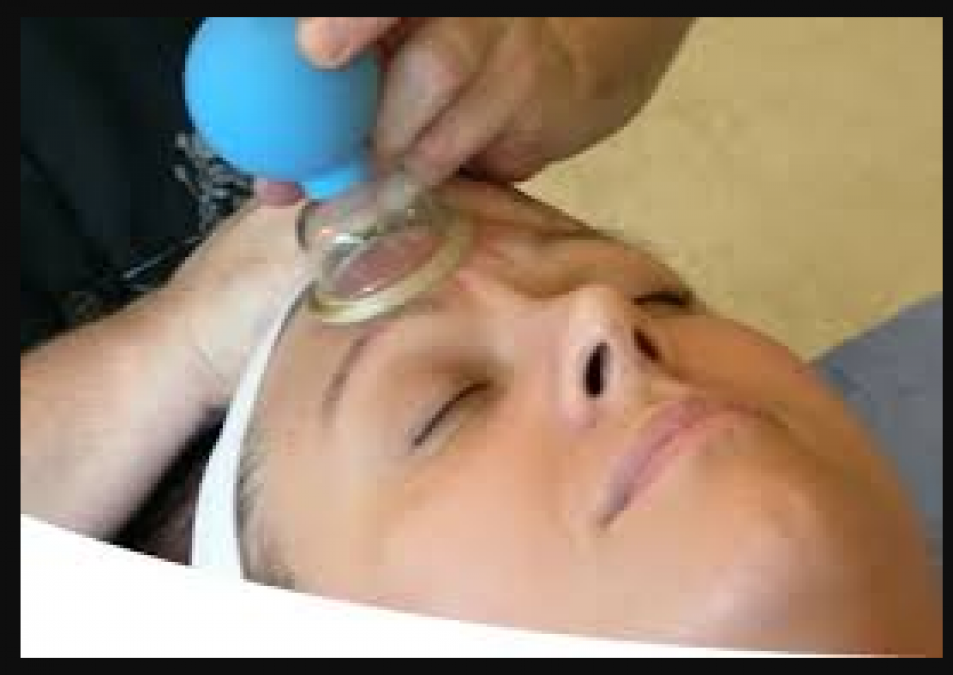 Know what is facial cupping treatment and what are its benefits