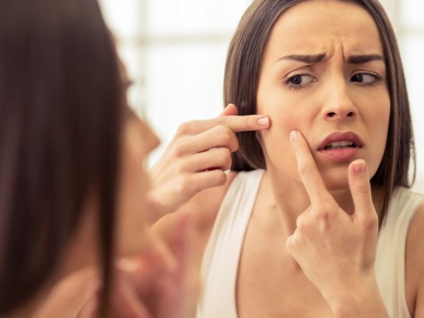 If You're Troubled by Pimples, Here's How to Get Rid of Them