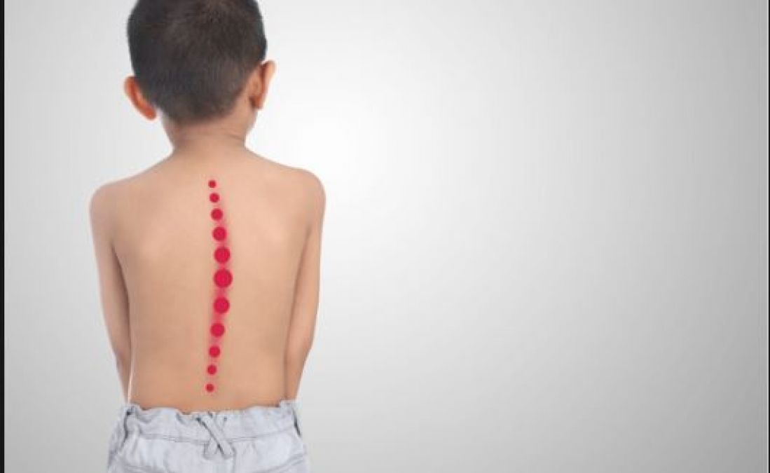If children are having back pain, then include these things in the diet