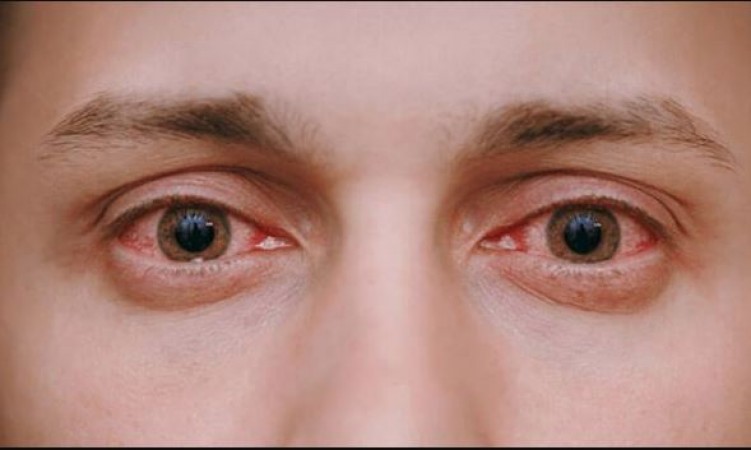 Identifying Signs of Weakening Eyesight