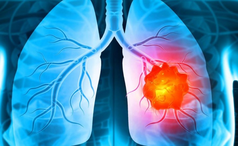 Follow these special tips for lung health