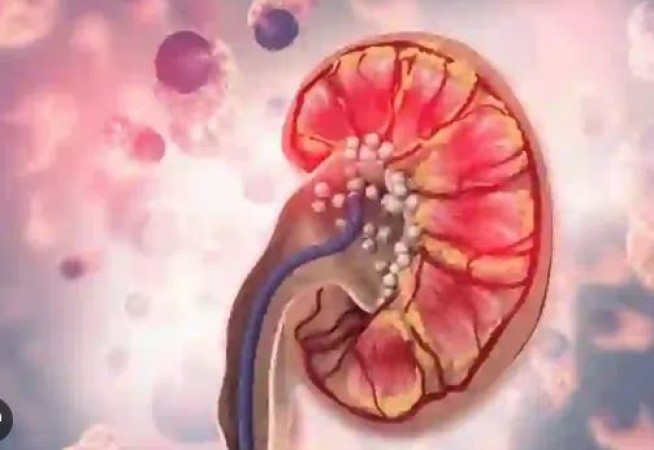 How to Protect the Kidney from Damage: Keep These Tips in Mind