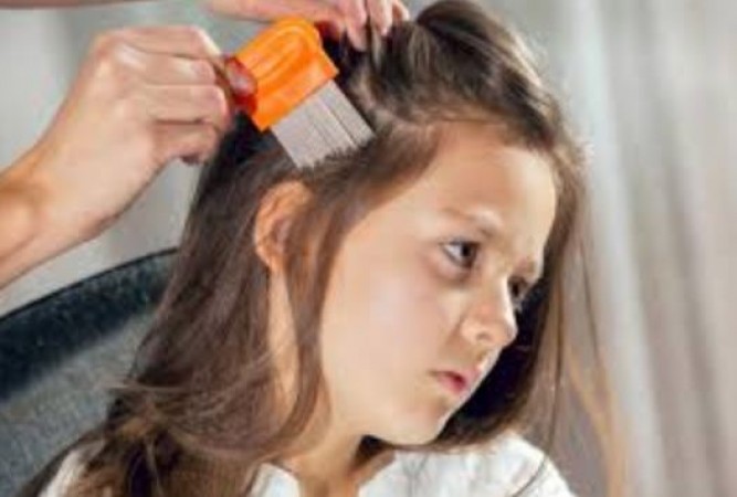 If Your Children Have Lice, Try This Home Remedy for Relief