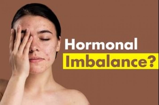 The Problem of Hormonal Imbalance in Women is Rapidly Increasing: Know the Symptoms and Treatment