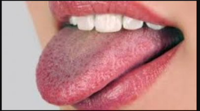 Take special care of cleaning tongue, follow these tips