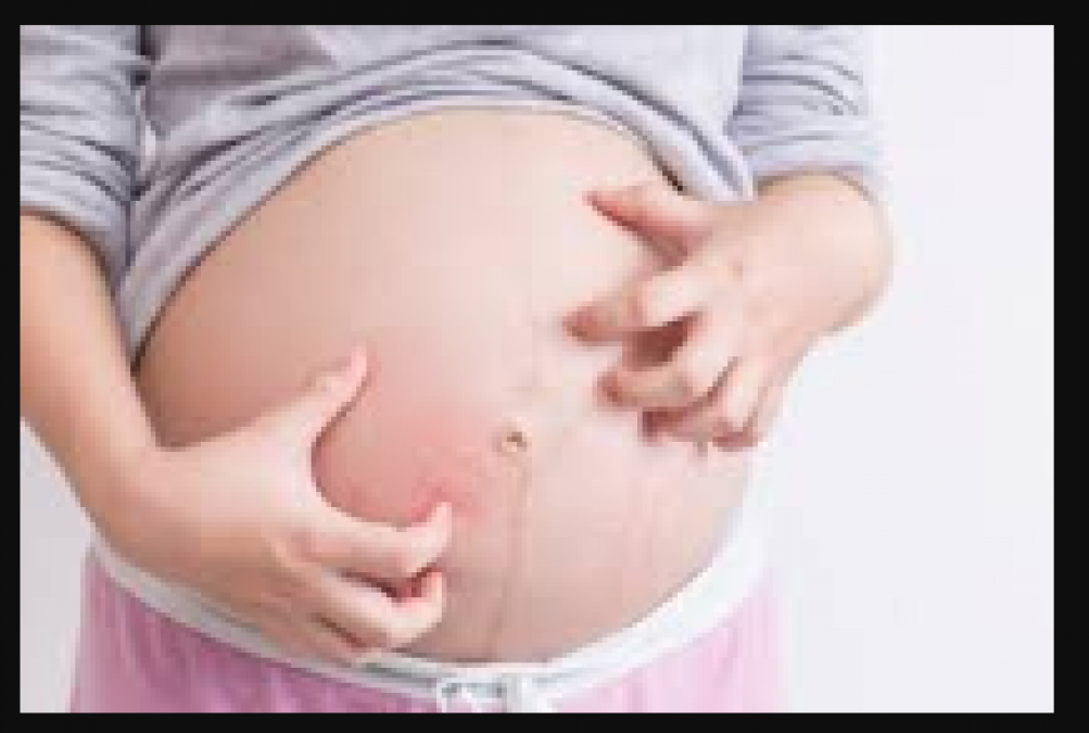 These problems occur during pregnancy, know how to deal with it
