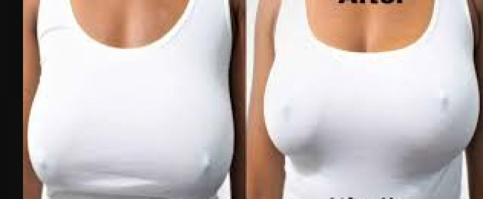 Avoid these habits to keep your breast in shape