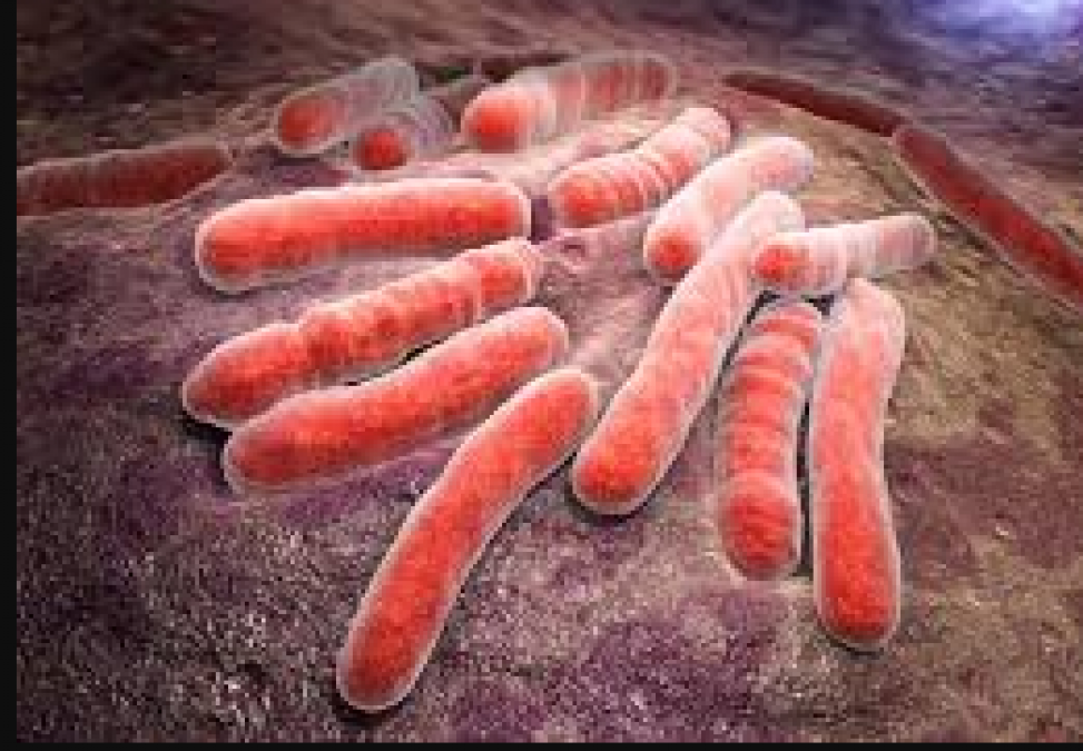 Tuberculosis: Know its causes and diagnosis