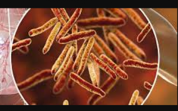 Tuberculosis: Know its causes and diagnosis
