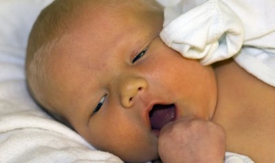 आखिर क्यों न्यूबॉर्न बेबी को हो जाता है पीलिया?