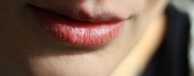 These marks on the lips can be cancerous, don't ignore it