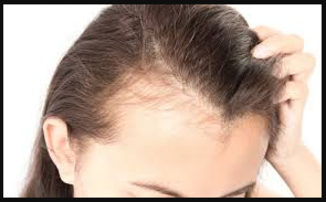 Hair may fall due to these diseases, know more