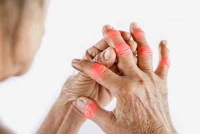 Increase These Foods in Your Diet When Arthritis Pain Worsens in Winter