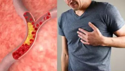 These Seeds Have the Power to Remove Sticky Bad Cholesterol from Arteries