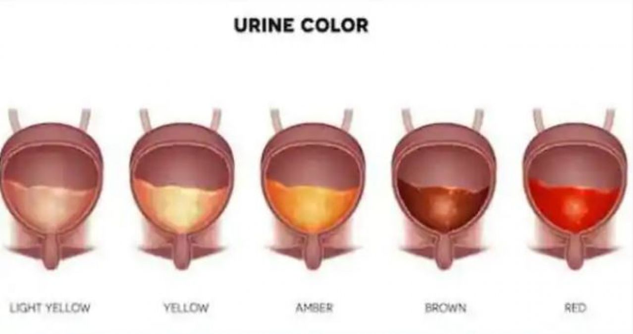 Know what your Urine Colors indicate about your health