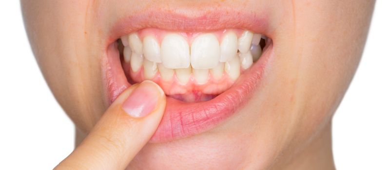 दांतों की समस्याओं को दूर करती है  नीम की पत्तियां