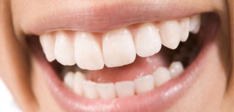 इन कारणों से भी दांतों को होता है नुकसान