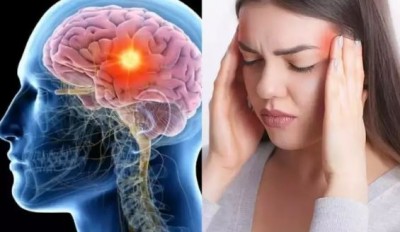 बार-बार हो रहा है तेज सिरदर्द तो हो सकता है ब्रेन ट्यूमर, फटने से हो जाएगी मौत