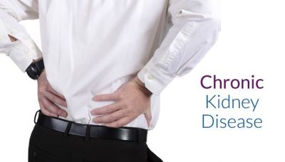 Symptoms and Signs of Kidney Failure, Causes & Stages