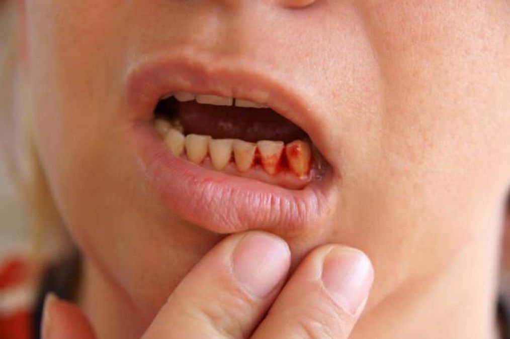 Follow these tips to protect children from tooth and gum disease