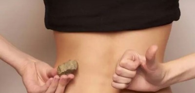 These 4 Types of Foods Are The Cause Of Kidney Stones