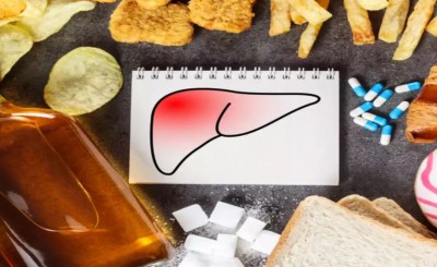 Not Only Alcohol, but Sweets Can Also Increase the Risk of Fatty Liver: How to Reduce This