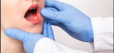 मुंह में छाले होते हैं माउथ कैंसर का संकेत, इन लक्षणों को न करें नजरअंदाज