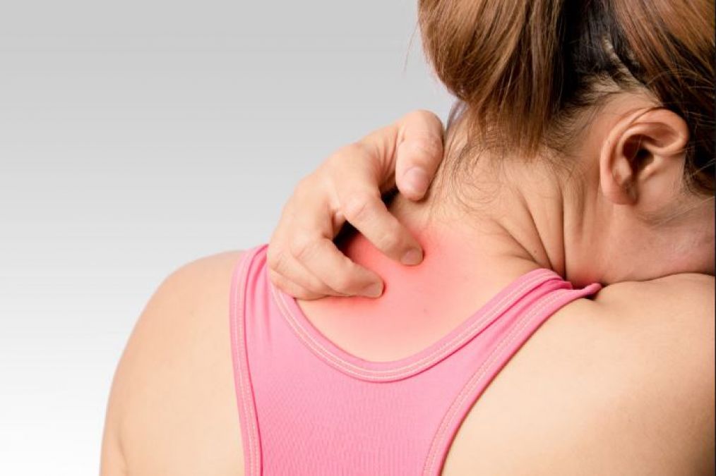 Get rid of Prickly Heart Rashes from these home remedies