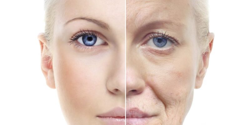 यह अंतर होता है Age spots और Acne Spots के बीच