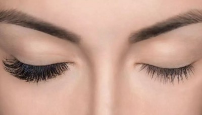 Are Your Eyelashes Falling Out? Don't Ignore It, Here's Why