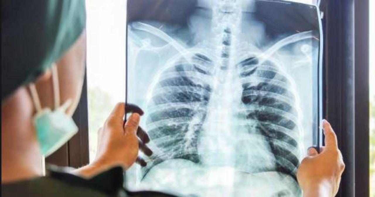 सावधान! X-ray करवाने से पहले पढ़े यह खबर वरना हो सकती है ये गंभीर बीमारी!