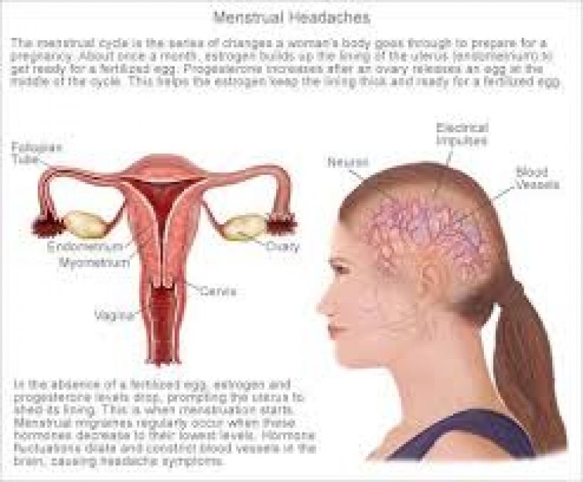 Hormone changes cause headaches, adopt these natural remedies