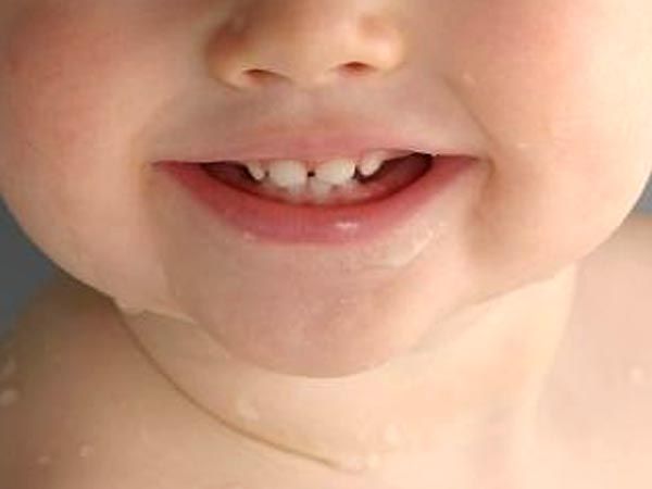 बेहद जरुरी है बच्चों के दांतों का ख्याल रखना, नहीं तो हो सकती है ये परेशानियां